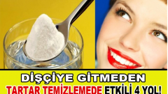 Dişçiye Gitmeden Diş Tartarlarından Kurtulun