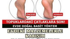 Topuk Çatlaklara için mucizevi çözümler