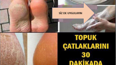 Evde Topuk Çatlaklarını Geçiren Karışım