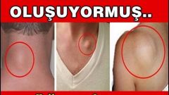 Öğrenince Şok Olacaksınız ! Bakın Yağ Bezeleri Neden Oluyormuş