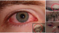 Genç Kadına Egzama Dediler Ama Keşke Egzama Olsaydı Diyeceksiniz Allah Yardımcısı Olsun