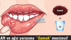 Aft Yaraları Neden Olur, Aft Nasıl Geçer