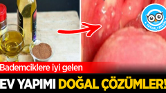 Bademciklere iyi gelen ev yapımı doğal çözümler