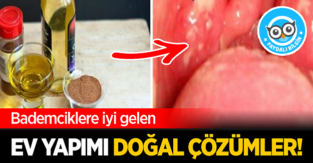 Bademciklere iyi gelen ev yapımı doğal çözümler