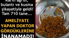 Karın ağrısı, bulantı ve kusma şikayetiyle geldi! Tam 710 tane