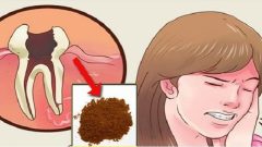 Diş ağrısı kabusunuz olmasın