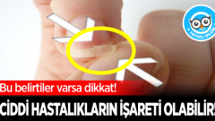 Bu belirtiler varsa dikkat! Ciddi hastalıkları işareti olabilir