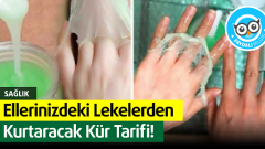 Ellerinizdeki Lekelerden Kurtaracak Kür Tarifi
