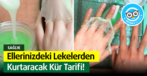 Ellerinizdeki Lekelerden Kurtaracak Kür Tarifi