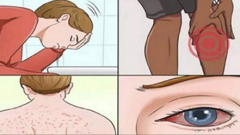 Kalp Hastalığının 17 Belirtisi Risk Altında Olduğunuzu Nasıl Anlarsınız