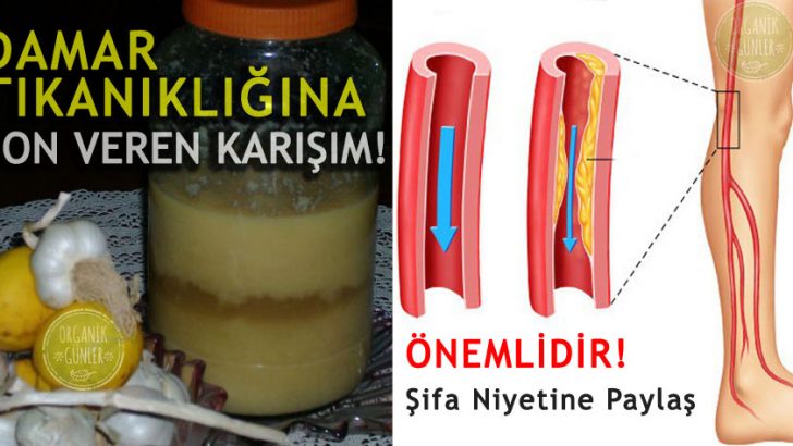 Limon Sarımsak Kürü Nasıl Yapılır Faydaları Nelerdir