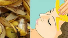 Ne Varsa Doğada Var Migren Ağrılarını Bıçak Gibi Kesen 5 Yöntem