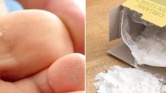 Nasır Nasıl Geçer 4 Doğal Tedavi Yöntemi