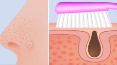 Evinizdeki 3 Malzemeyle Siyah Noktalardan Kurtulun