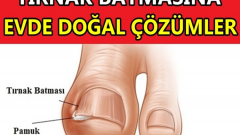 Tırnak Batması Ve Tedavi Yöntemleri