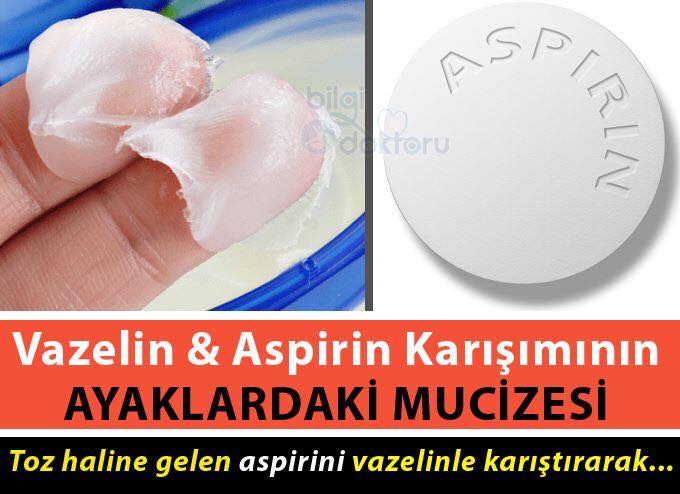 Ayak Topuğu Yumuşatıcı Vazelin Aspirin Yöntemi