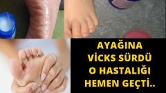 Ayağına Vicks Sürdü O Hastalığı Hemen Geçti Meğer Çok Faydalıymış