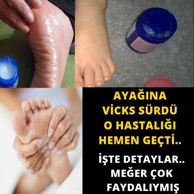 Ayağına Vicks Sürdü O Hastalığı Hemen Geçti Meğer Çok Faydalıymış