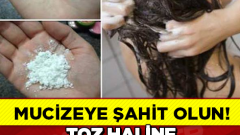 Toz Haline Getirdiğiniz Aspirini Saçınıza Sürün Ve