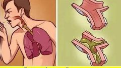 Balgamlı Öksürüğü 2 Saatte Akciğerden Komple Atıyor