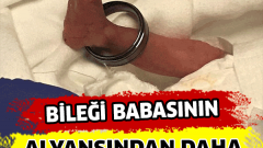 Bileği Alyanstan Daha Küçük