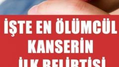 İşte en ölümcül kanserin belirtisi doktora gitmeyi ihmal etmeyin