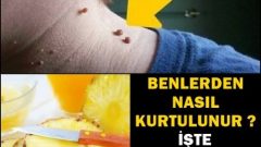 Benlerden Nasıl Kurtulunur İşte Kurtulmak İçin Doğal Yöntem