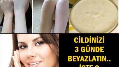 Cildinizi 3 Günde Limon İle Beyazlatabilirsiniz İşte O Formül
