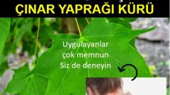 İbrahim Saraçoğlu Çınar Yaprağı Kireçlenme Kürü