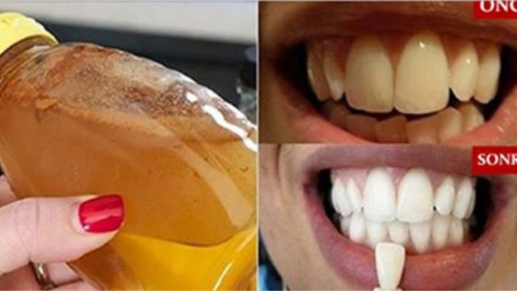 Evde Kendiniz Bu Doğal Yöntemle Dişlerinizi Bembeyaz Yapabilirsiniz Hem de Sadece Her Evde Bulunan 3 Malzeme ile