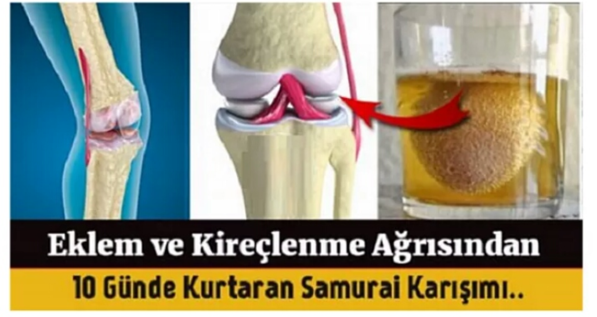 Eklem ağrılarını gideren elma sirkesi yumurta kabuğu tedavisi