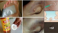 Et Benleri için Çörek Otu Yağı Tedavisi.. Bunu Kullananlar Bakın Nasıl Kurtuldu