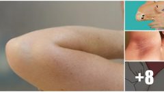 Kararan Bölgeleri Hemen Ve Kesin Çözüm Hemen Deneyin