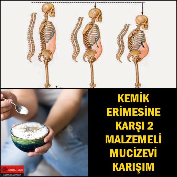 Kemik Erimesine Karşı 2 Malzemeli Mucizevi Karışım