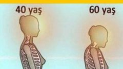 Kemik Erimesine Karşı Doğal Bir Çözüm