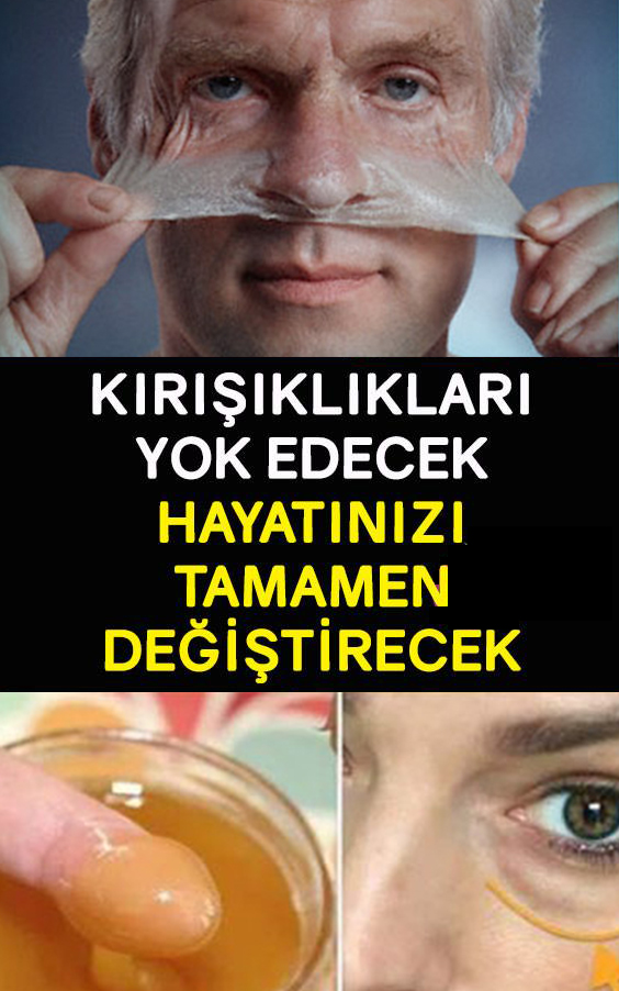 Kırışıklıkları Yok Edecek Hayatınız Tamamen Değişecek