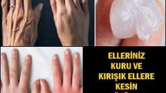 Kuru Ve Kırışık Ellere Kesin Çözüm Bakın Nasıl Uygulanıyor
