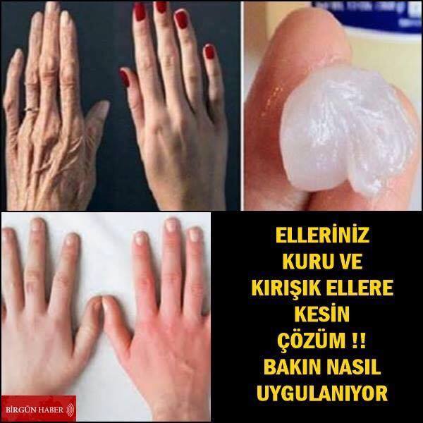 Kuru Ve Kırışık Ellere Kesin Çözüm Bakın Nasıl Uygulanıyor