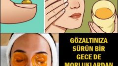 Gözaltınıza Sürün Bir Gece de Morluklardan Ve Torbalardan Kurtulun