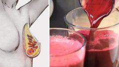 Kanseri önleyen kırmızı pancar meyve sebze detoksu