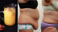 Bu inanılmaz Bu Güçlü reçeteyle Karnınızı 3 Günde sıkılaştırın