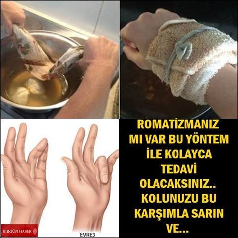 Romatizmanız mı Var Bu Yöntem İle Kolayca Tedavi Olacaksınız.Kolunuzu Bu Karışımla Sarın Ve