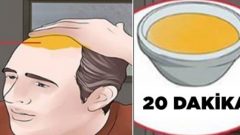 Saç dökülmesi duracak ve yeni saçlar çıkacak