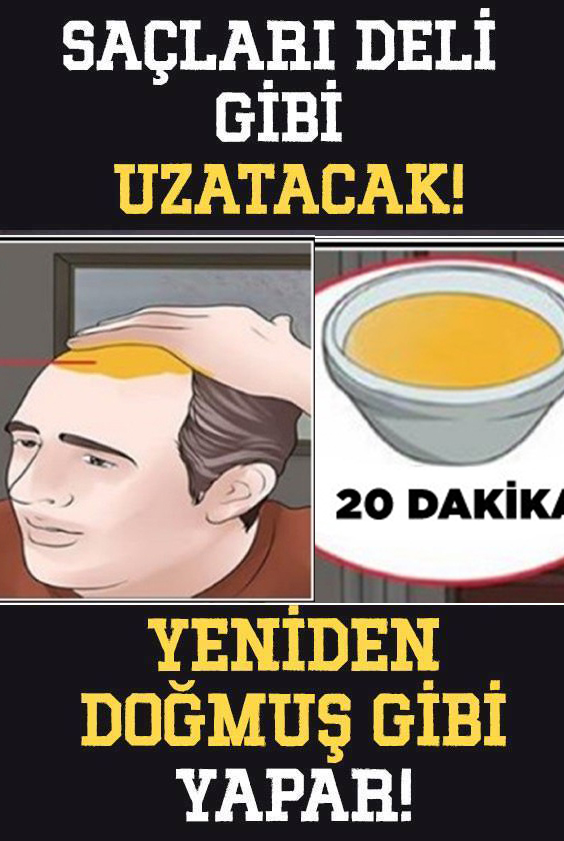 Saç dökülmesi duracak ve yeni saçlar çıkacak