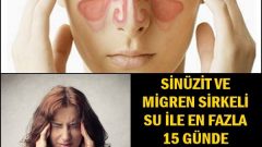 Sinüzit Ve Migren Sirkeli Su İle Bitiyor Hemde Bakın Nasıl