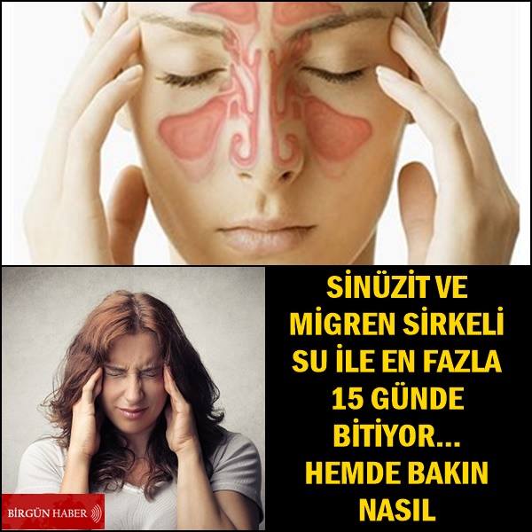 Sinüzit Ve Migren Sirkeli Su İle Bitiyor Hemde Bakın Nasıl