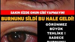 Görünmez Büyük Tehlike Sadece Burnunu Sildi Bakın Ne Hale Geldi