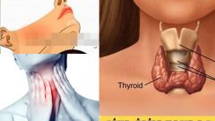 Tiroide Reset Atıp Yağları Parçalayan Yöntem