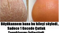 Büyükannem bana bu hileyi söyledi.. Sadece 1 Gecede Çatlak Topuklarımı İyileştirdi