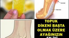 Topuk Dikeni Başta Olmak Üzere Ayak İçin En İyi İlaç Bakın Neymiş